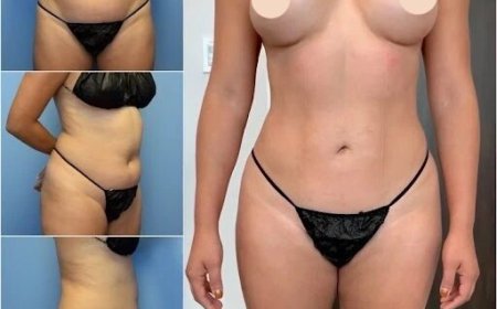 How Body Contouring in Dubai Can Help You Lose Stubborn Fat