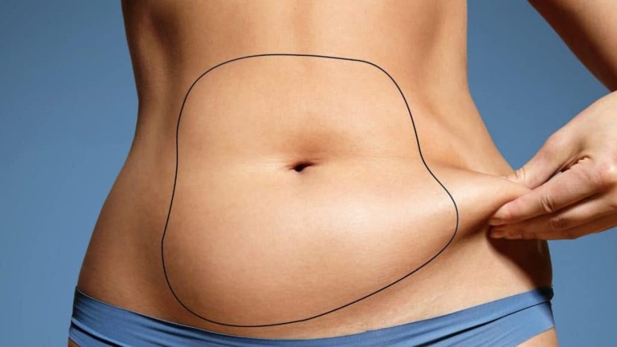 Contour Goals Achieved Inside From Best Liposuction Surgeon in Dubai