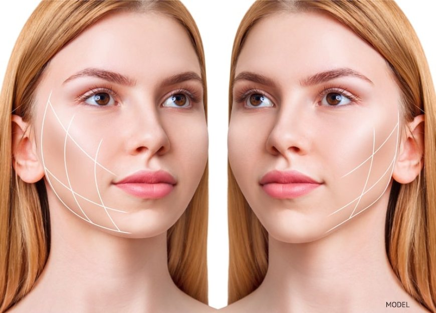 Unlocking the Power of the SMAS Lift: A Modern Facelift Solution